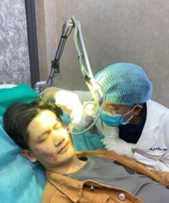 Laser Fractional CO2 điều trị sẹo
