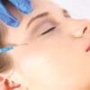 Botox Nếp chân chim 02 bên (Xeomin)