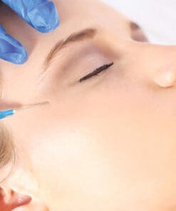 Botox Nếp chân chim 02 bên (Xeomin)