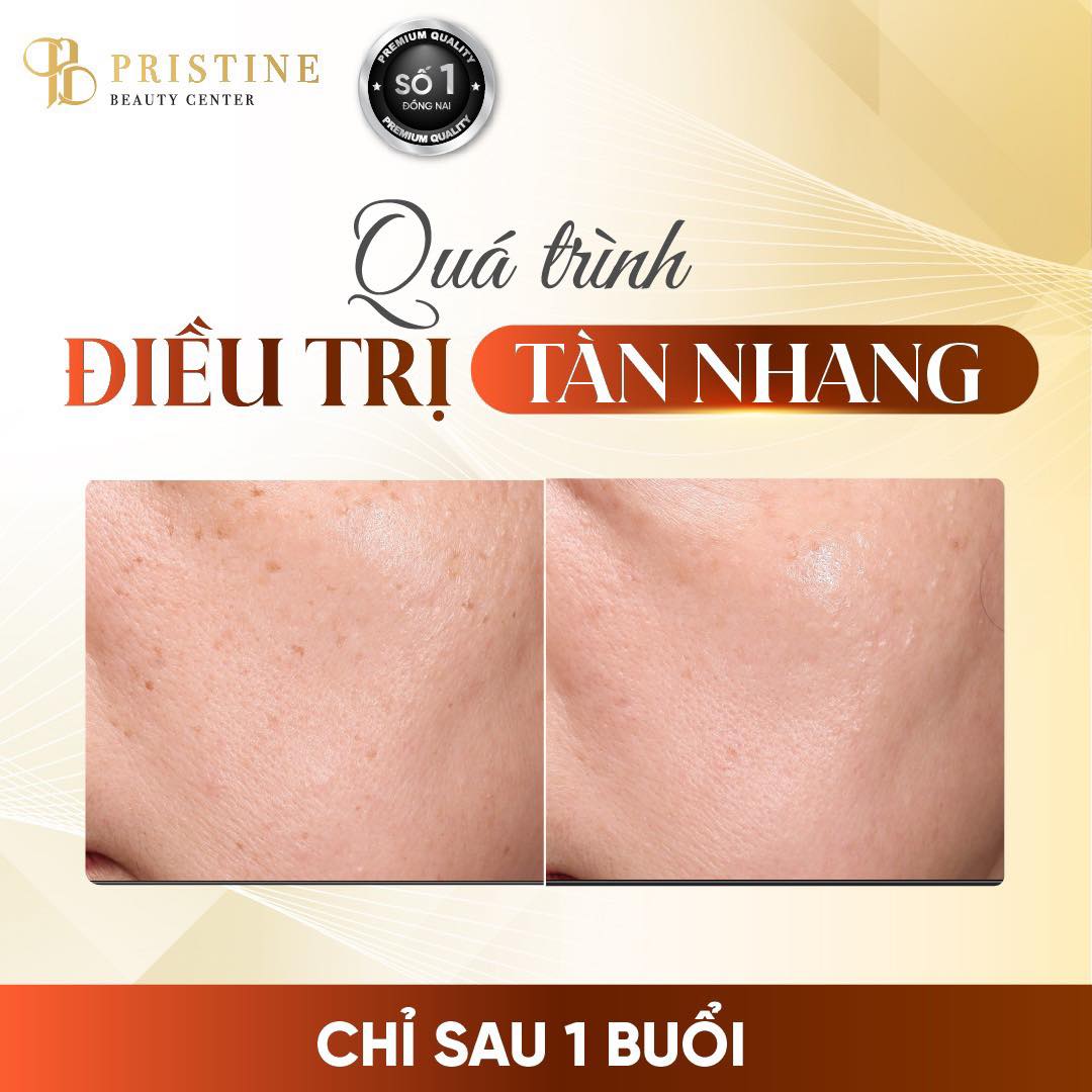 Trang chủ - New