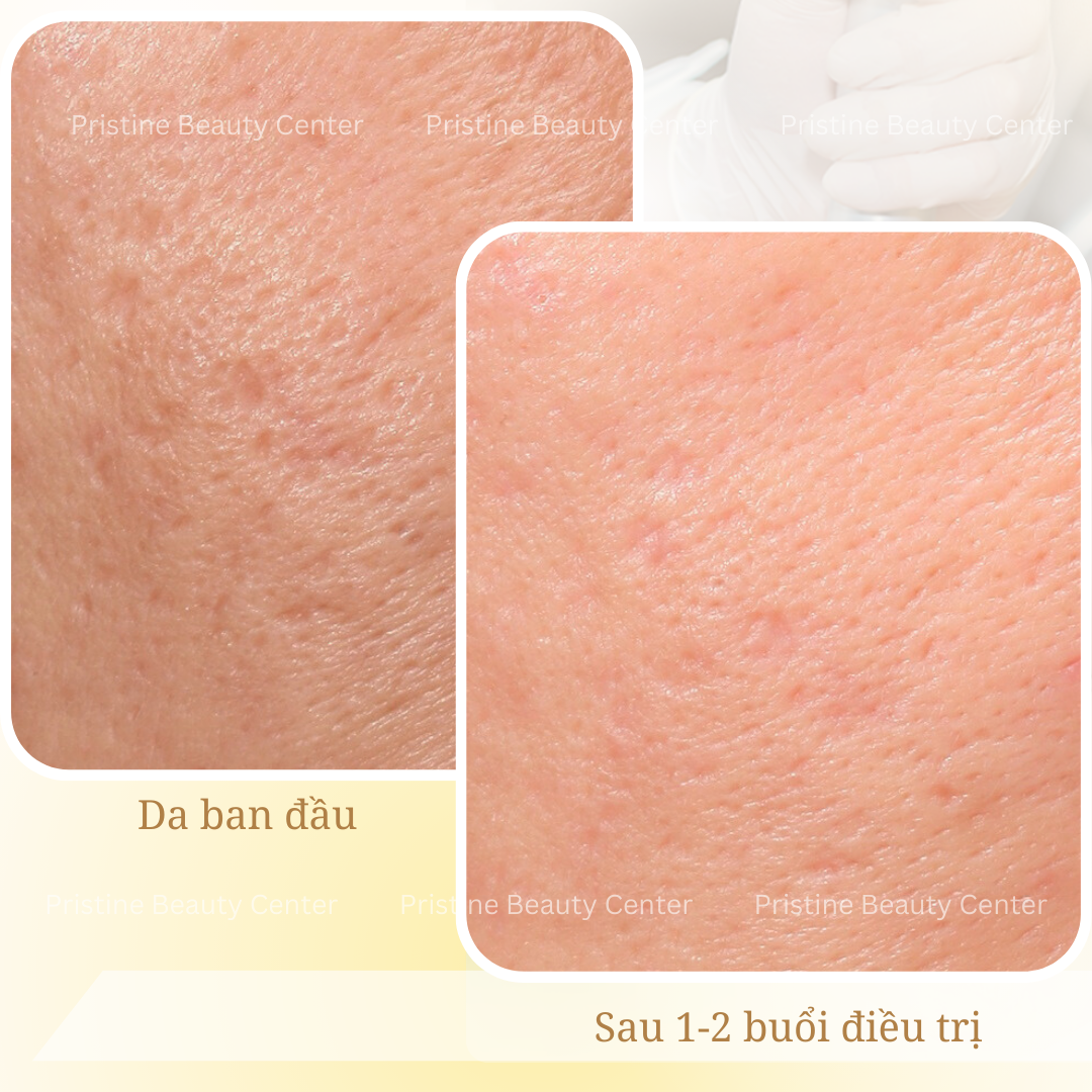 feedback-dieu-tri-seo-ro-1