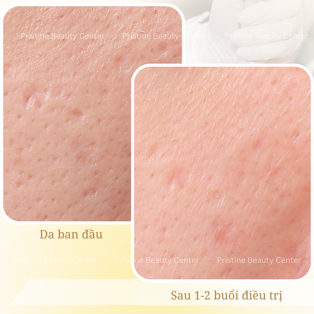 feedback-dieu-tri-seo-ro-2
