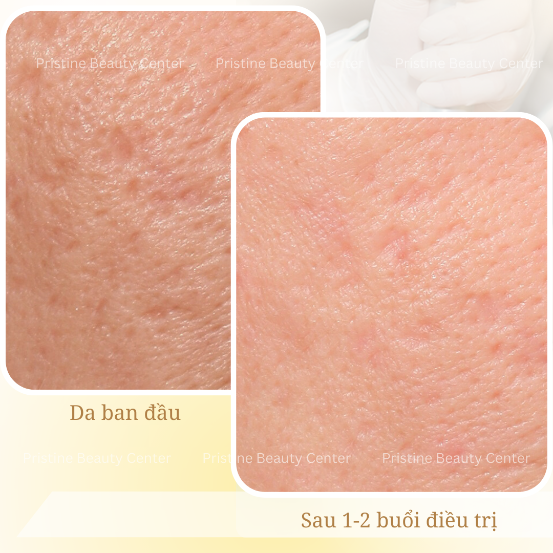 feedback-dieu-tri-seo-ro-3