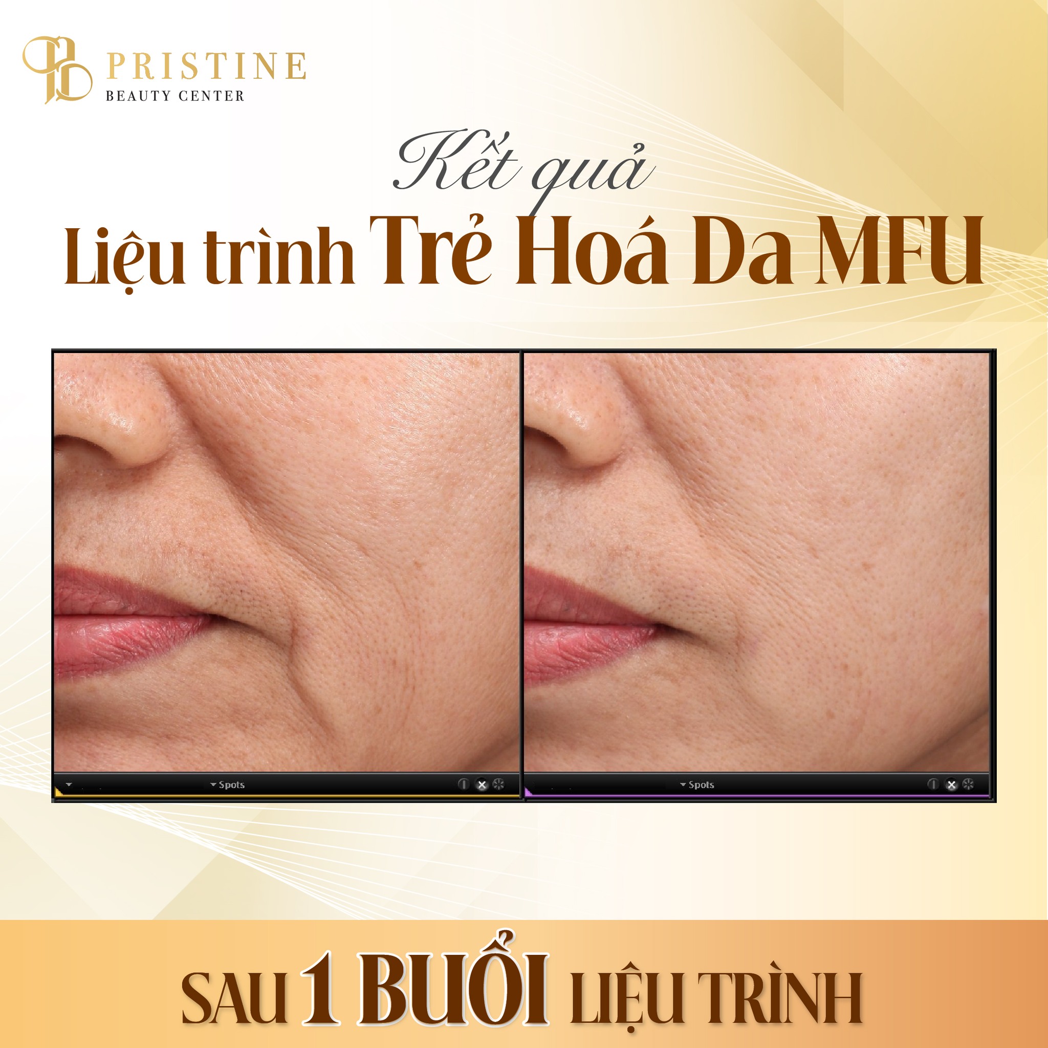 Trẻ hóa da