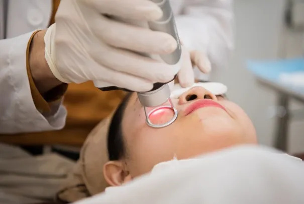 Điều trị Sẹo/rỗ