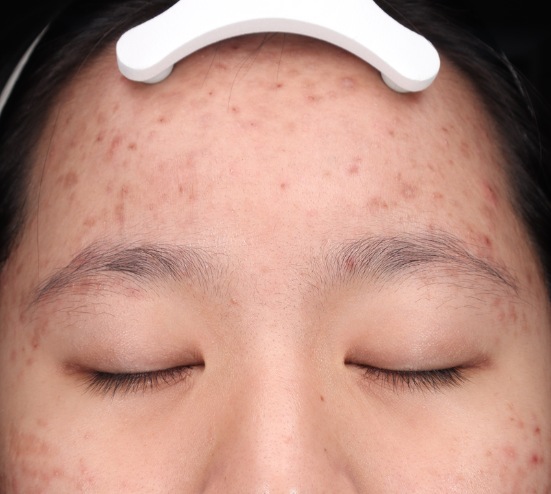 Hiệu quả điều trị