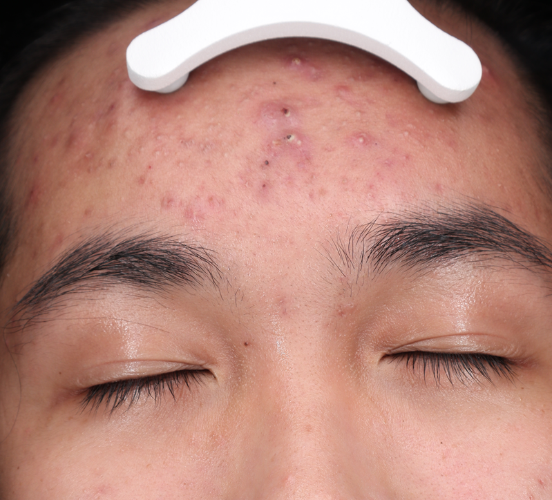Hiệu quả điều trị