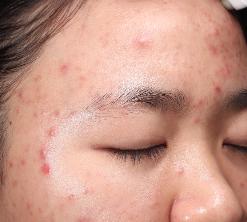 Hiệu quả điều trị