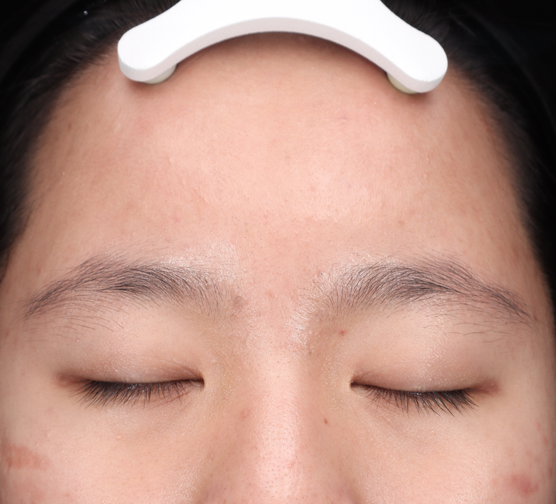 Hiệu quả điều trị