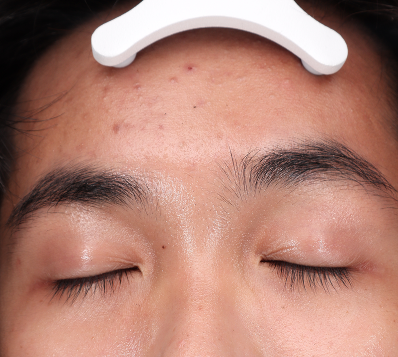 Hiệu quả điều trị