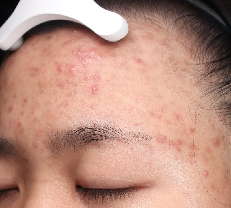 Hiệu quả điều trị
