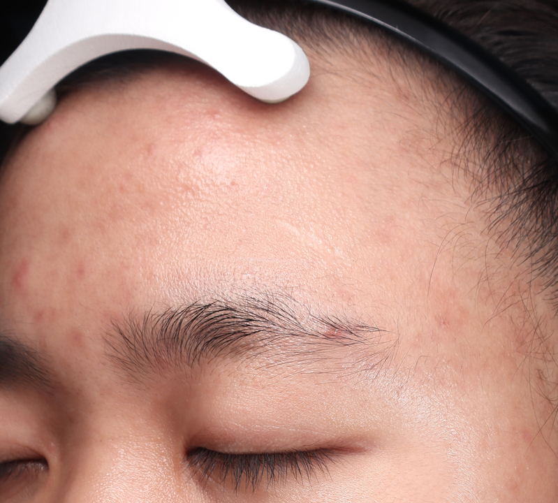 Hiệu quả điều trị