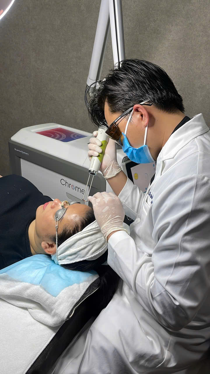 trẻ hóa da mặt với Laser toning