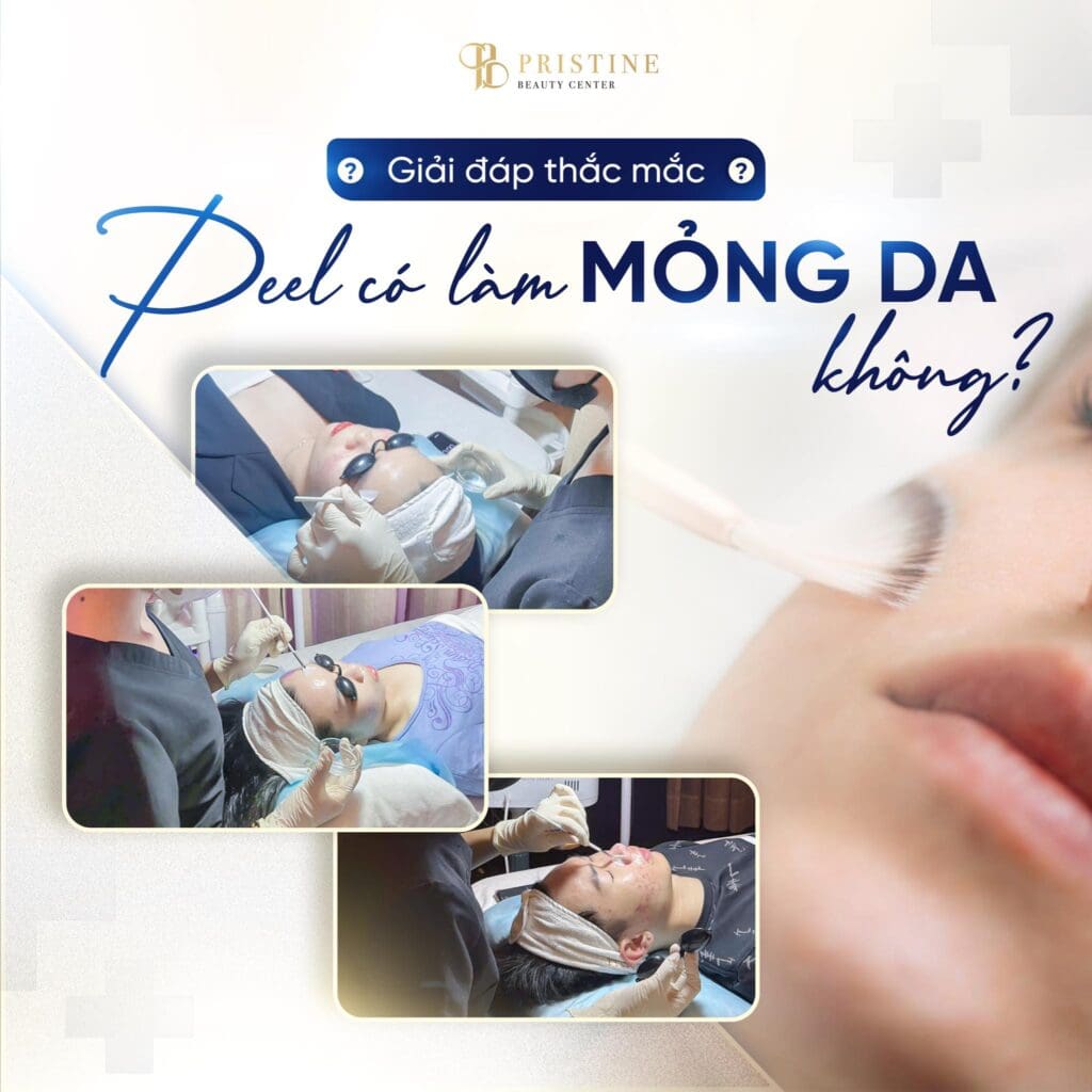 Peel da có làm mỏng da không? Sự thật bạn cần biết 1 peel-da-co-lam-mong-da-khong-2