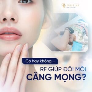 rf-moi-co-giup-moi-cang-mong-tu-nhien