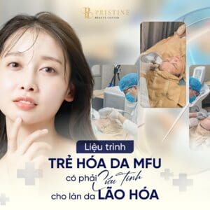 Điều trị trẻ hóa da bằng công nghệ MFU – Bí quyết trẻ lâu không cần dao kéo