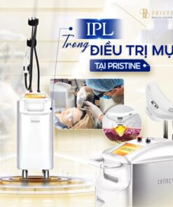 IPL mụn