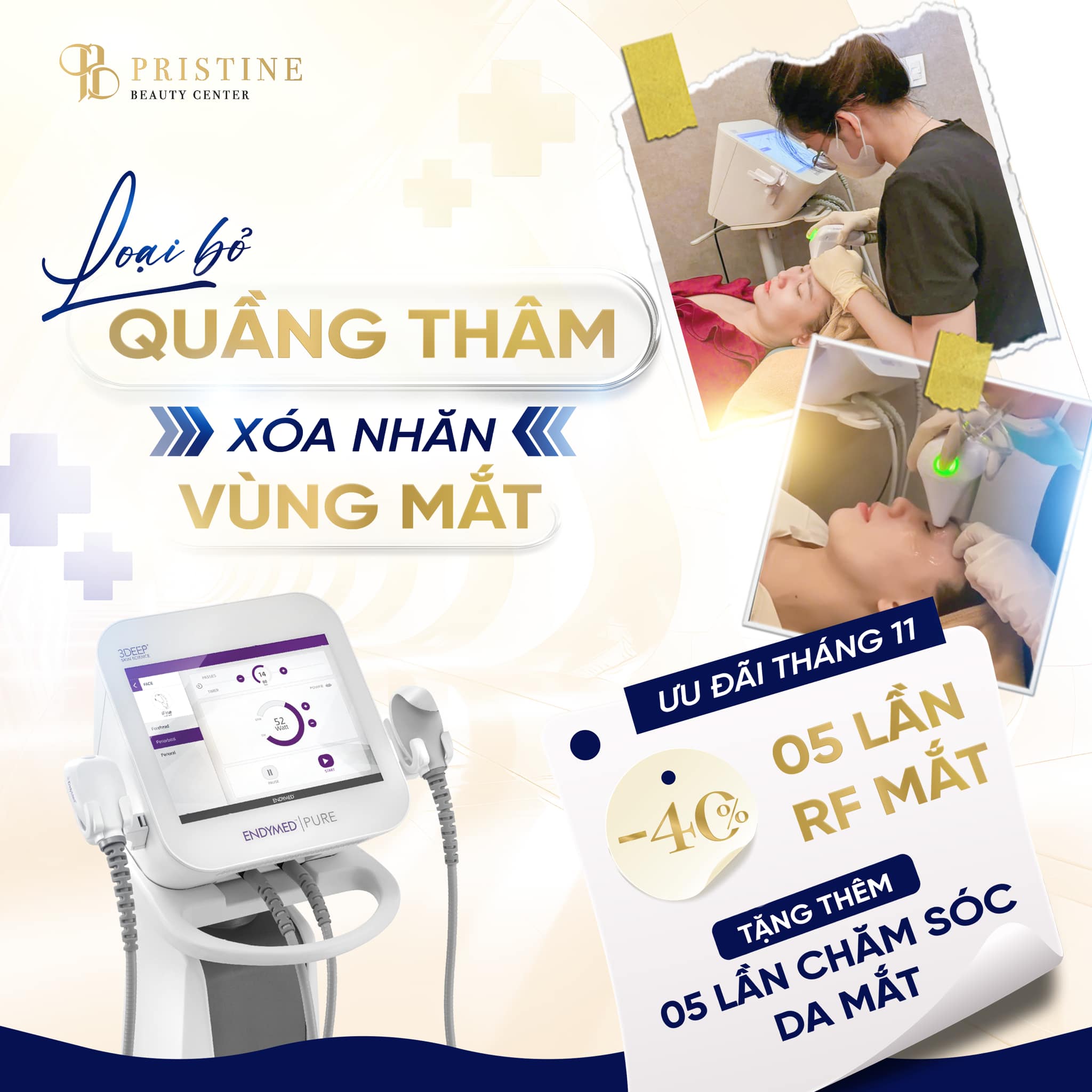 xoa-nhan-vung-mat-pristine-beauty-center