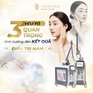 Các yếu tố quan trọng cần biết khi điều trị nám