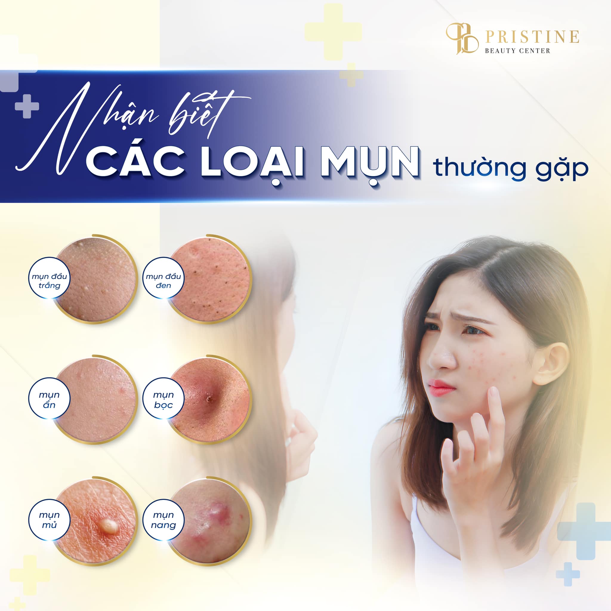 Các loại mụn cần biết