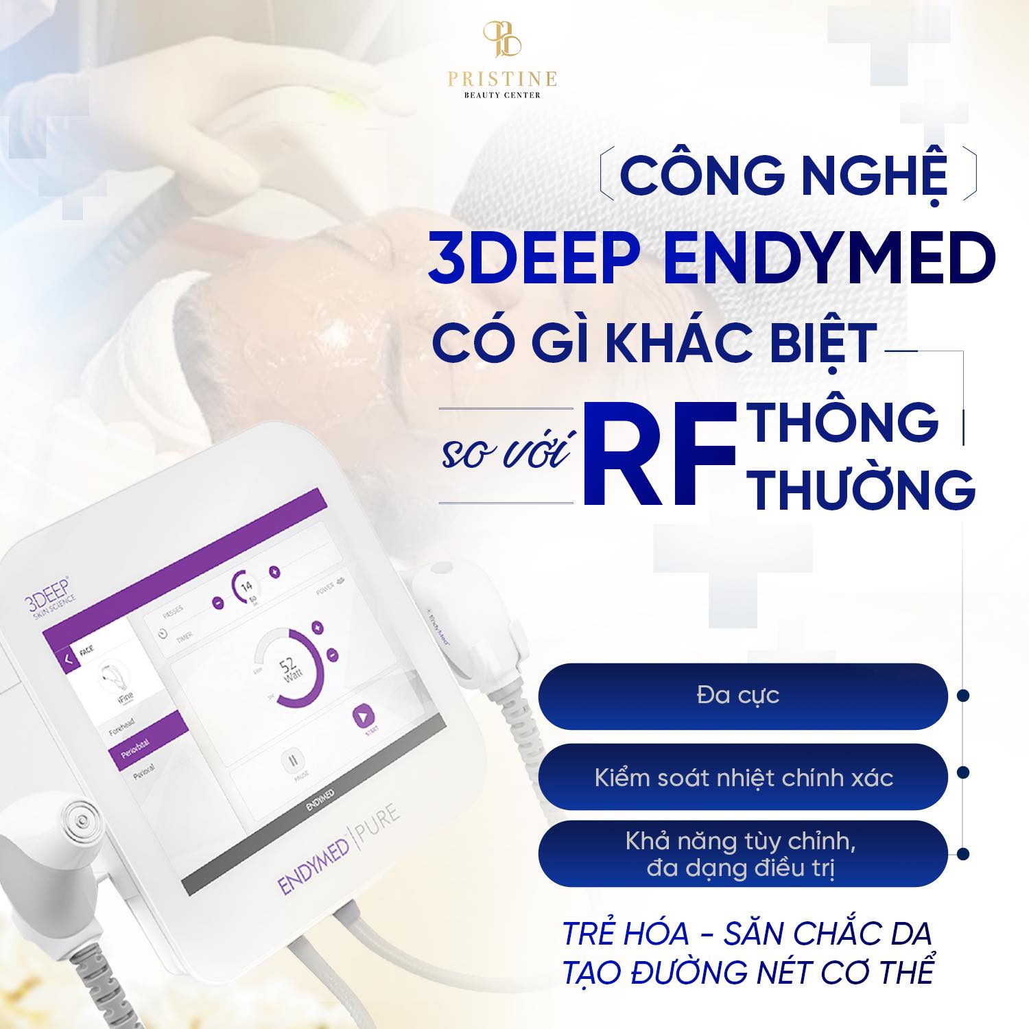 RF Endymed – Công nghệ RF 3DEEP tiên tiến giúp săn da, giảm mỡ hiệu quả 2 Sự khác biệt giữa công nghệ 3deep Endymed so với RF thường