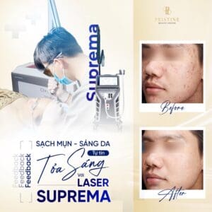 Điều trị mụn viêm, mụn bọc: Quy trình chuẩn y khoa tại phòng khám da liễu