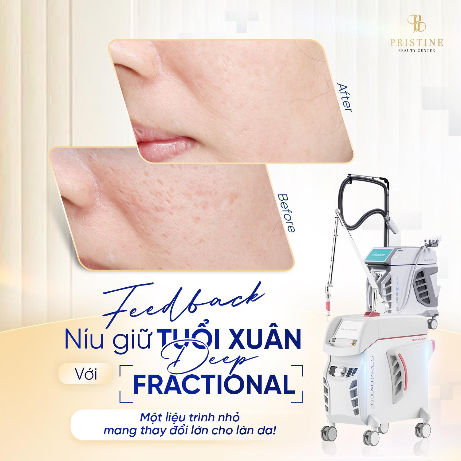 Cải thiện cấu trúc da hiệu quả