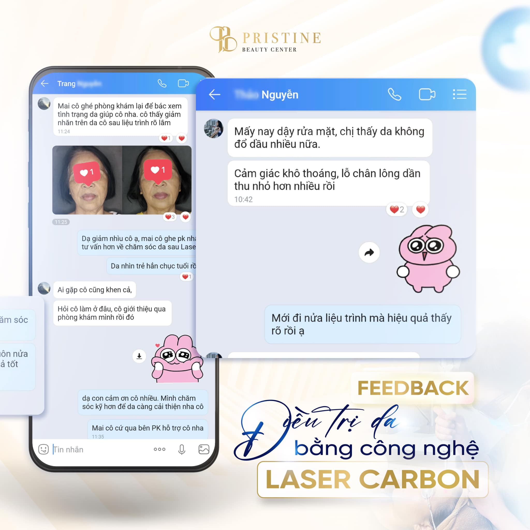 Laser PC Carbon: Phân tích cơ chế hấp thụ - bóc tách carbon - trẻ hóa bề mặt 6 Feeadback từ khách hàng của Pristine Beauty Center