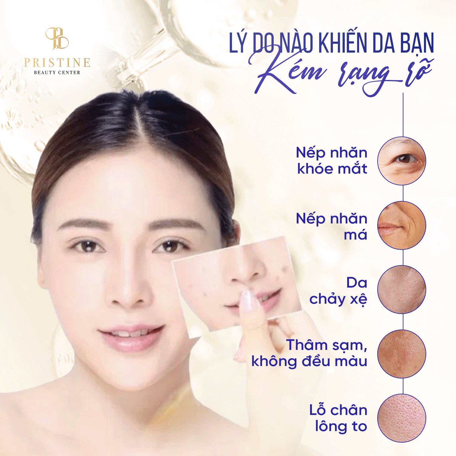 Trẻ hóa mắt không phẫu thuật - Giải cứu mí sụp, mắt bọng tại Pristine Beauty Center 2 Giải pháp khắc phục tình trạng vùng da mắt bị lão hoá