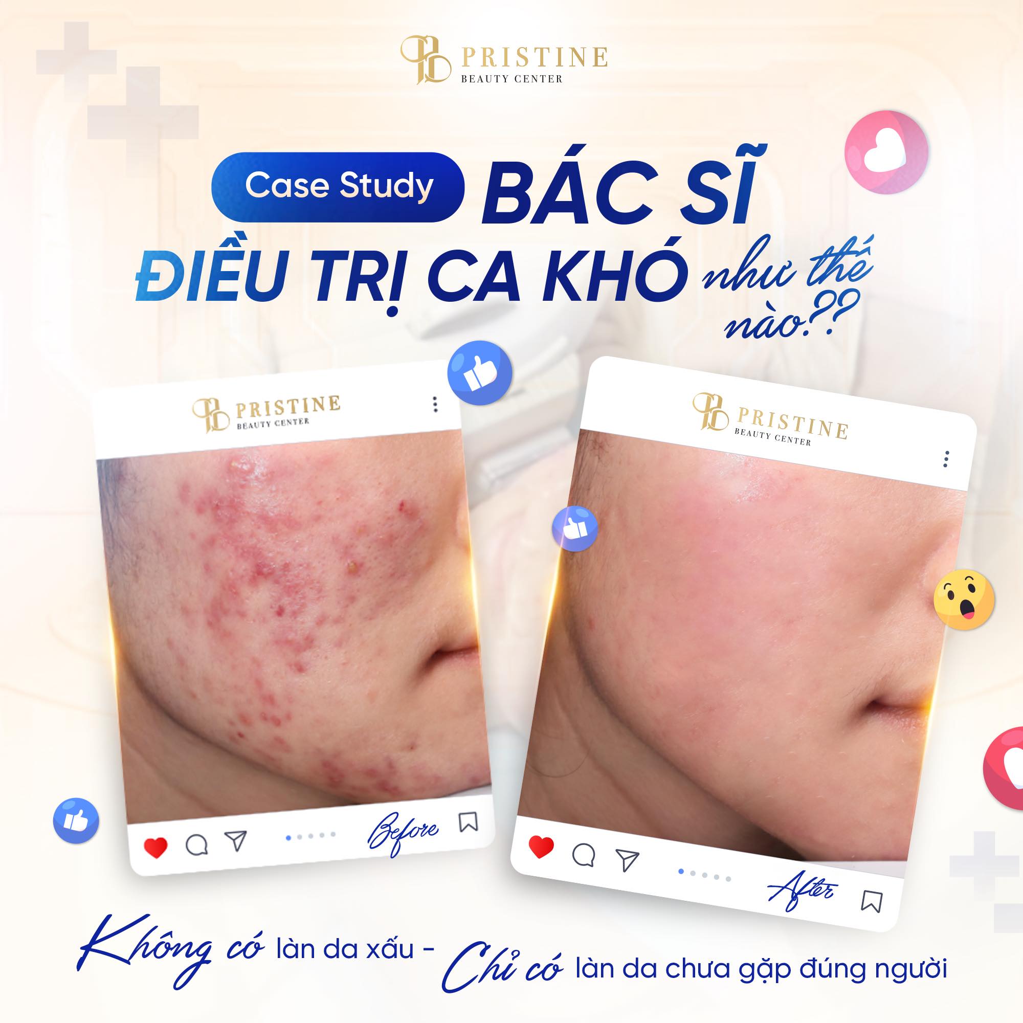 Kinh nghiệm lâu năm cũng giúp bác sĩ tối ưu liệu trình điều trị