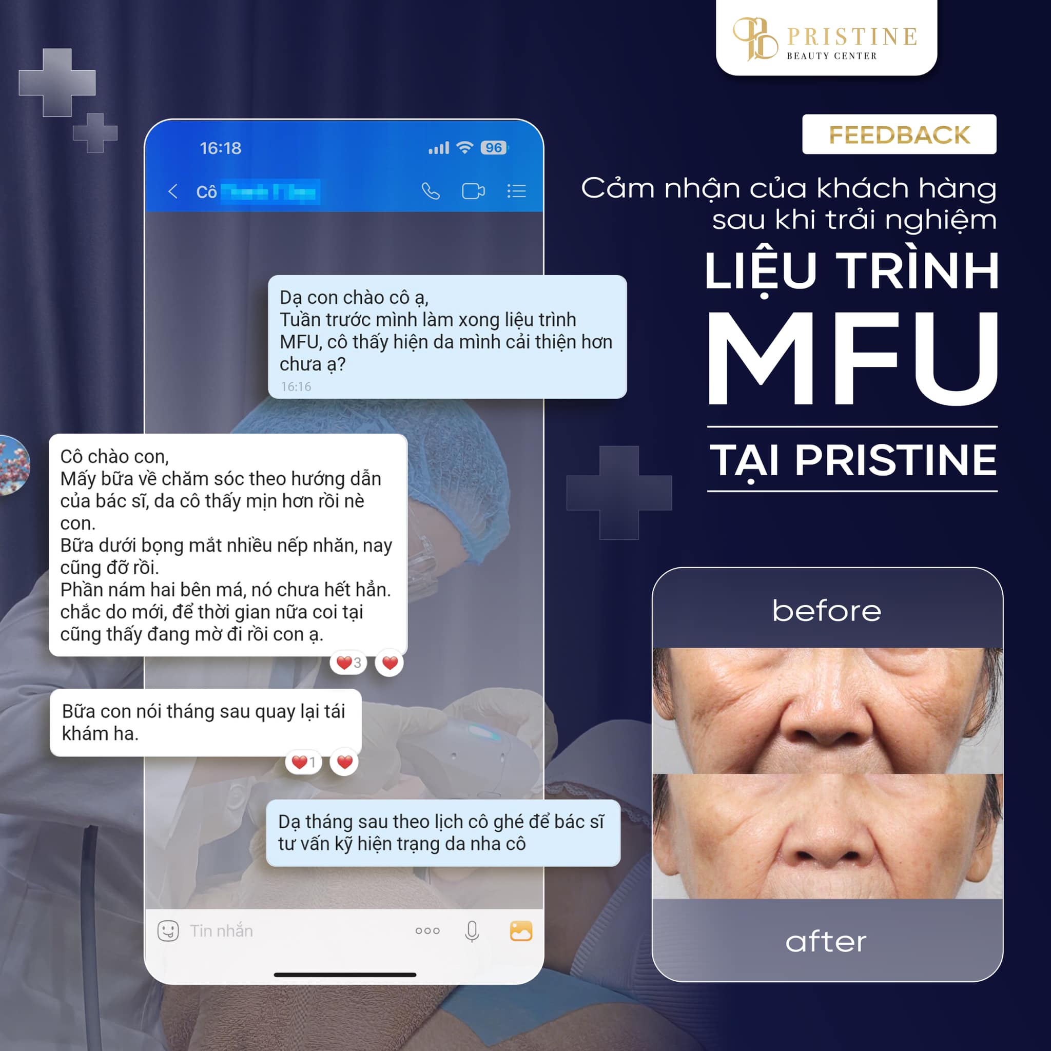 Phản hồi của khách hàng khi điều trị da tại phòng khám da liễu Biên Hoà