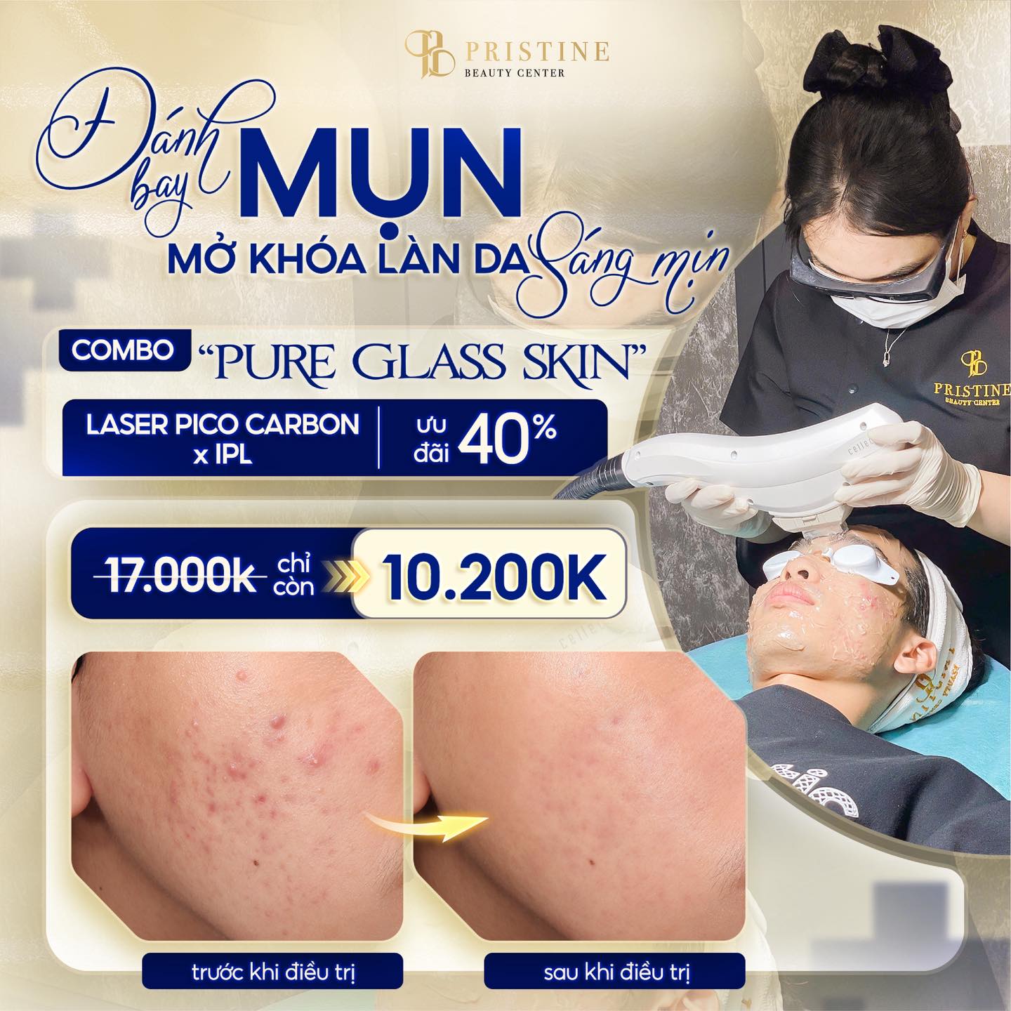 Điều trị mụn Công nghệ cao tại Biên Hòa: Top các phương pháp hiệu quả nhất hiện nay 5 Trị liệu bằng phác đồ đa công nghệ chuyên sâu