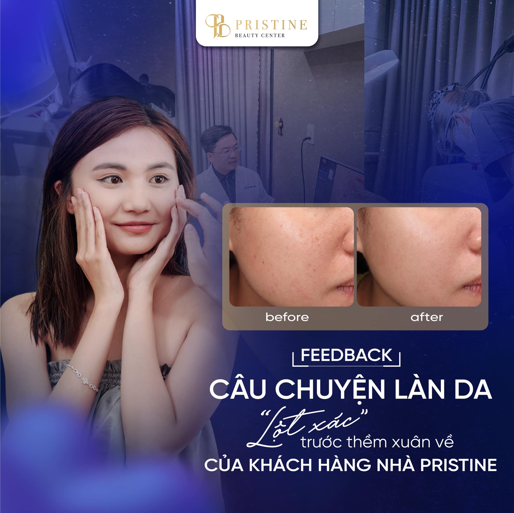 Hiệu quả điều trị nám thực tế của khách hàng tại phòng khám