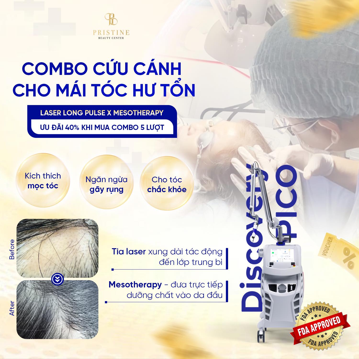 Phục hồi mái tóc thưa sau 1 liệu trình tại Pristine Beauty Center (Biên Hoà)