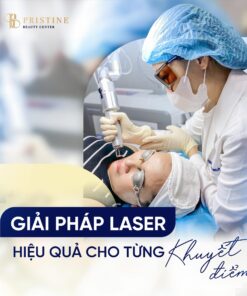 PC nám má 1 Giải pháp phù hợp với từng tình trạng nám
