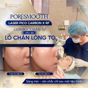 Pristine Beauty Center - Giải pháp chuyên biệt cho làn da lỗ chân lông to và kém sắc
