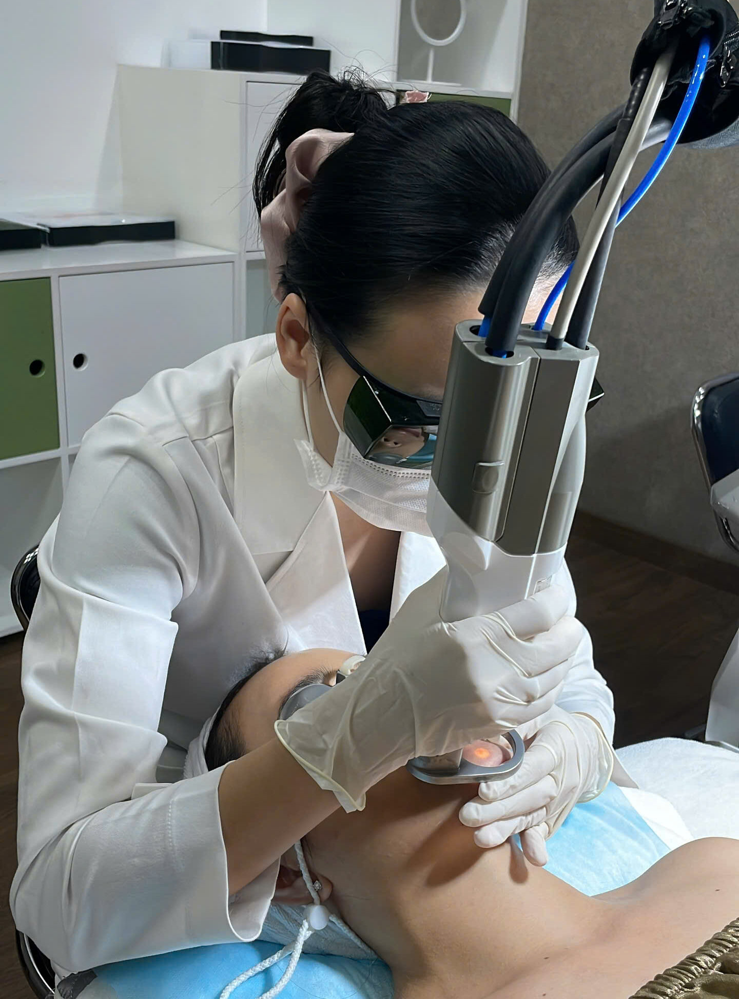 Laser Long pulse - Suprema - Triệt lông mặt