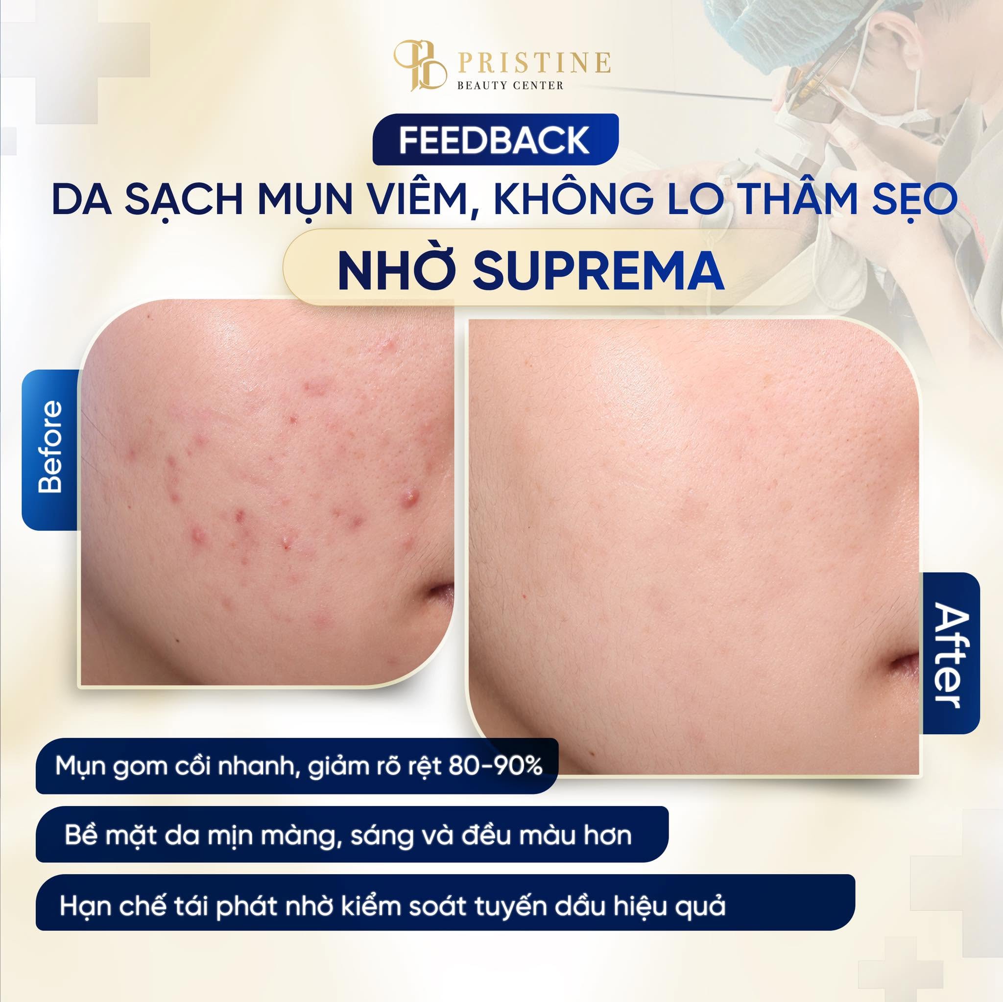 TRỊ MỤN CHUẨN Y KHOA THEO PHÁC ĐỒ CÁ NHÂN HÓA TỪ BÁC SĨ DA LIỄU