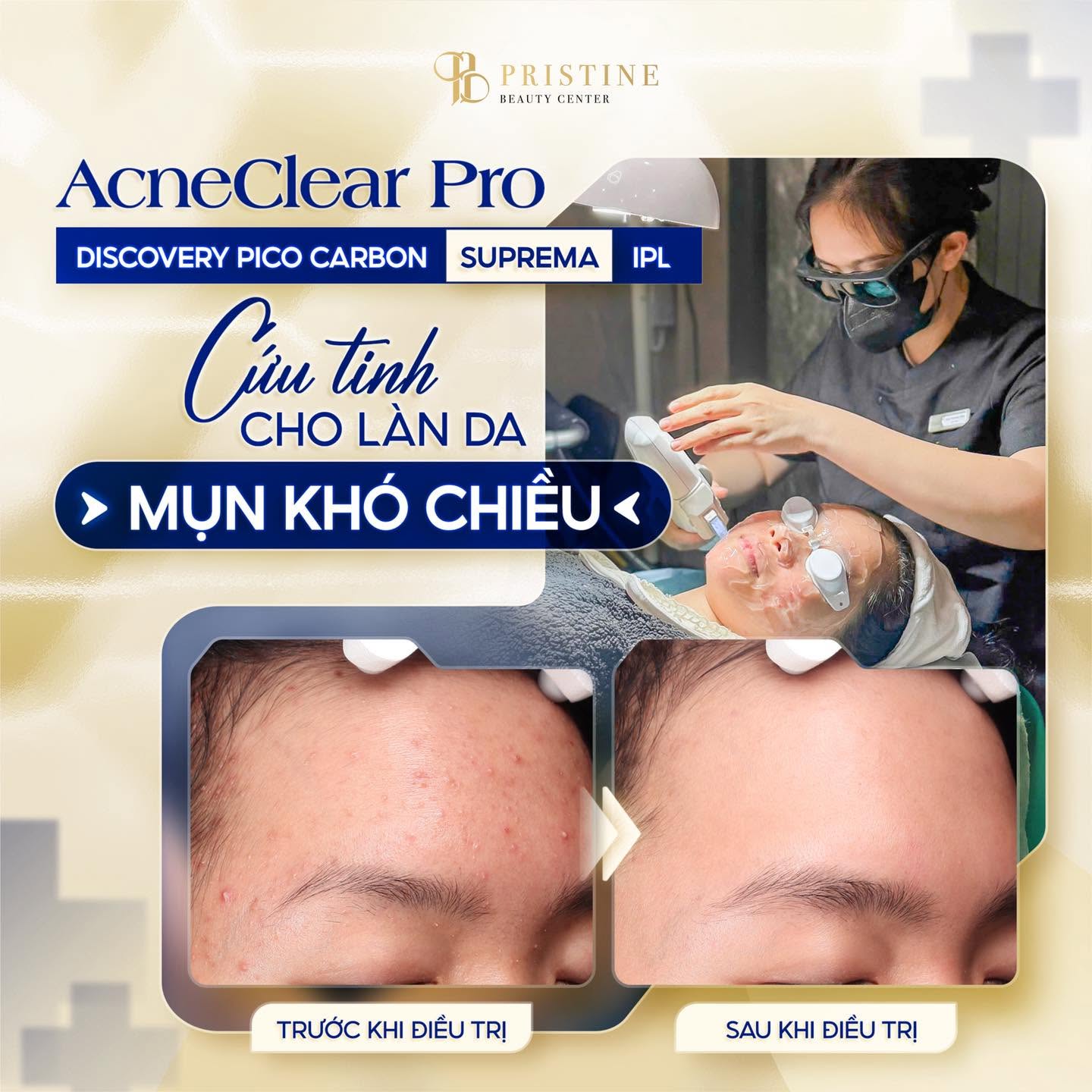 Nơi Điều Trị Mụn Uy Tín Tại Biên Hòa Chuẩn Y Khoa Toàn Diện 6 Feedback điều trị mụn tại Phòng khám Da liễu Biên Hoà