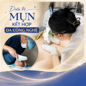 dieu-tri-mun-da-cong-nghe