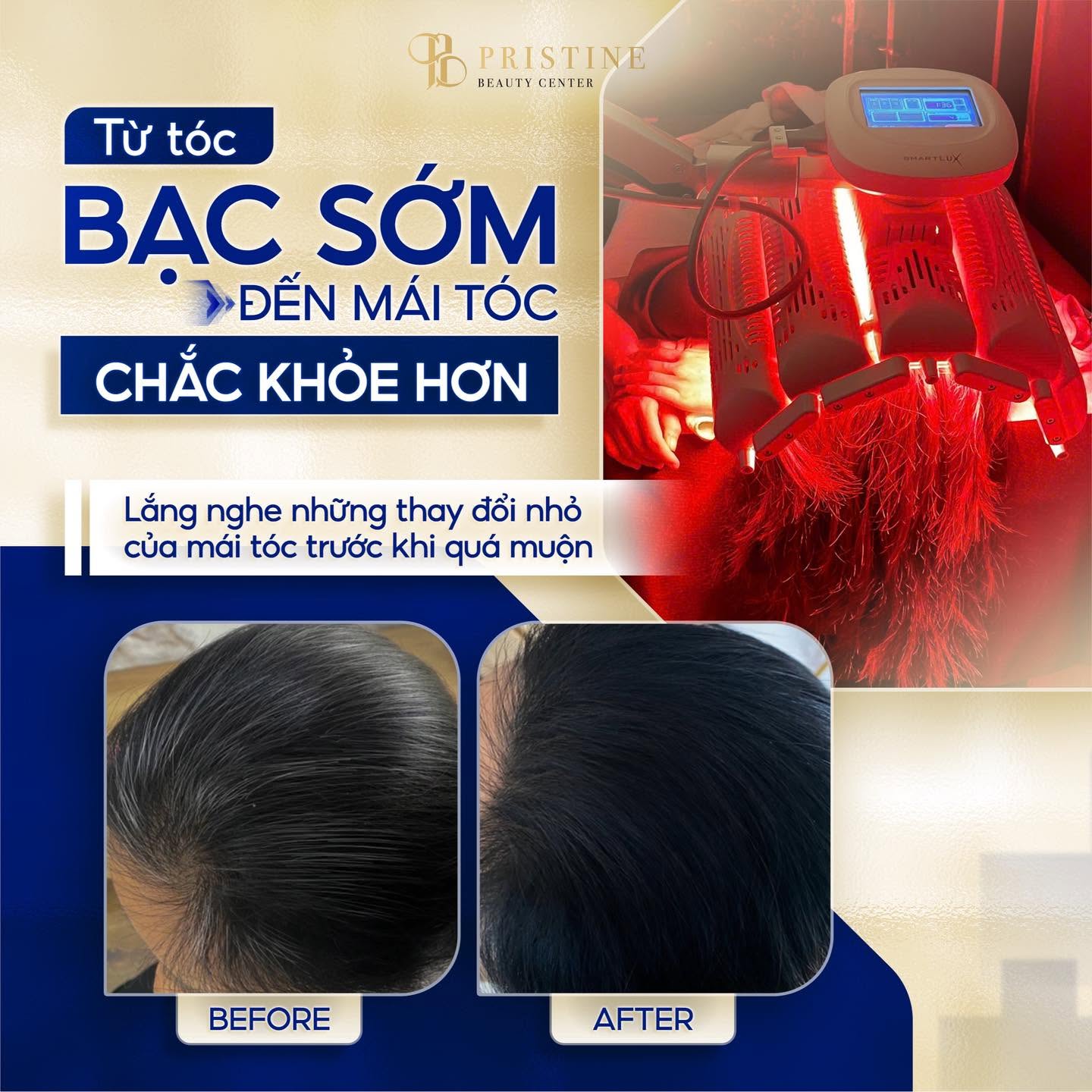 Điều trị tóc bạc sớm bằng công nghệ Redtouch uy tín tại Biên Hoà