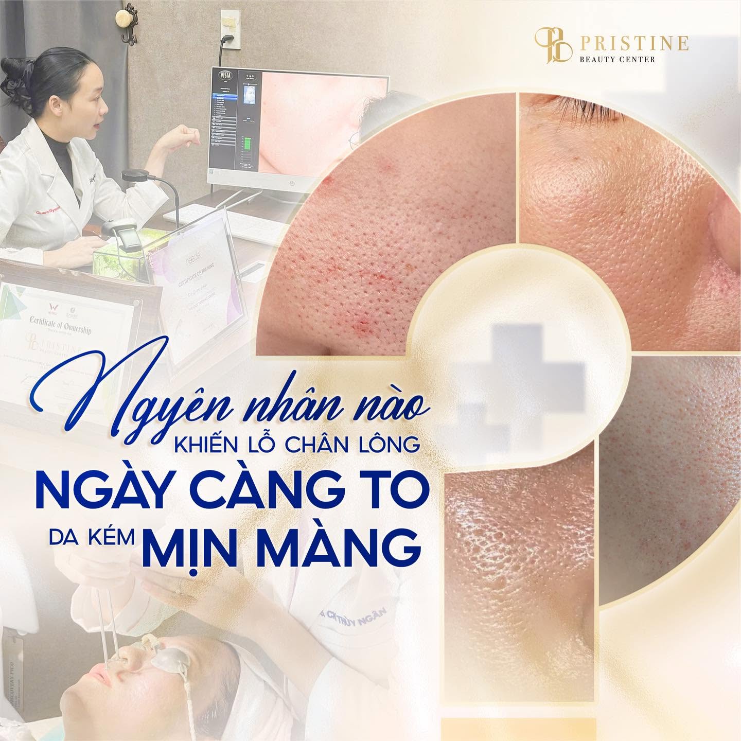 Lỗ chân lông to: Nguyên nhân và cách cải thiện hiệu quả 4 Vệ sinh không đúng cách là nguyên nhân khiến lỗ chân lông trên da mặt to hơn