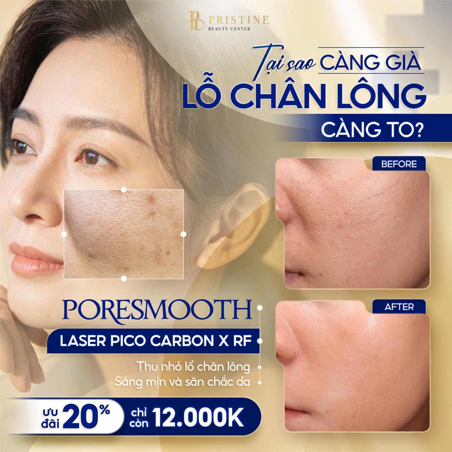 Lỗ chân lông to: Nguyên nhân và cách cải thiện hiệu quả 3 Di truyền và giới tính góp phần làm lỗ chân lông bị to