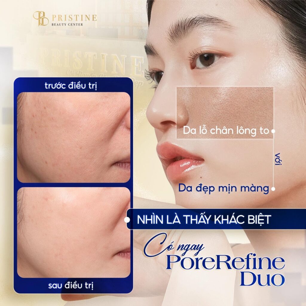 Triệt lông mặt bằng công nghệ hiện đại