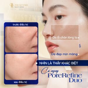 Triệt lông mặt bằng công nghệ hiện đại