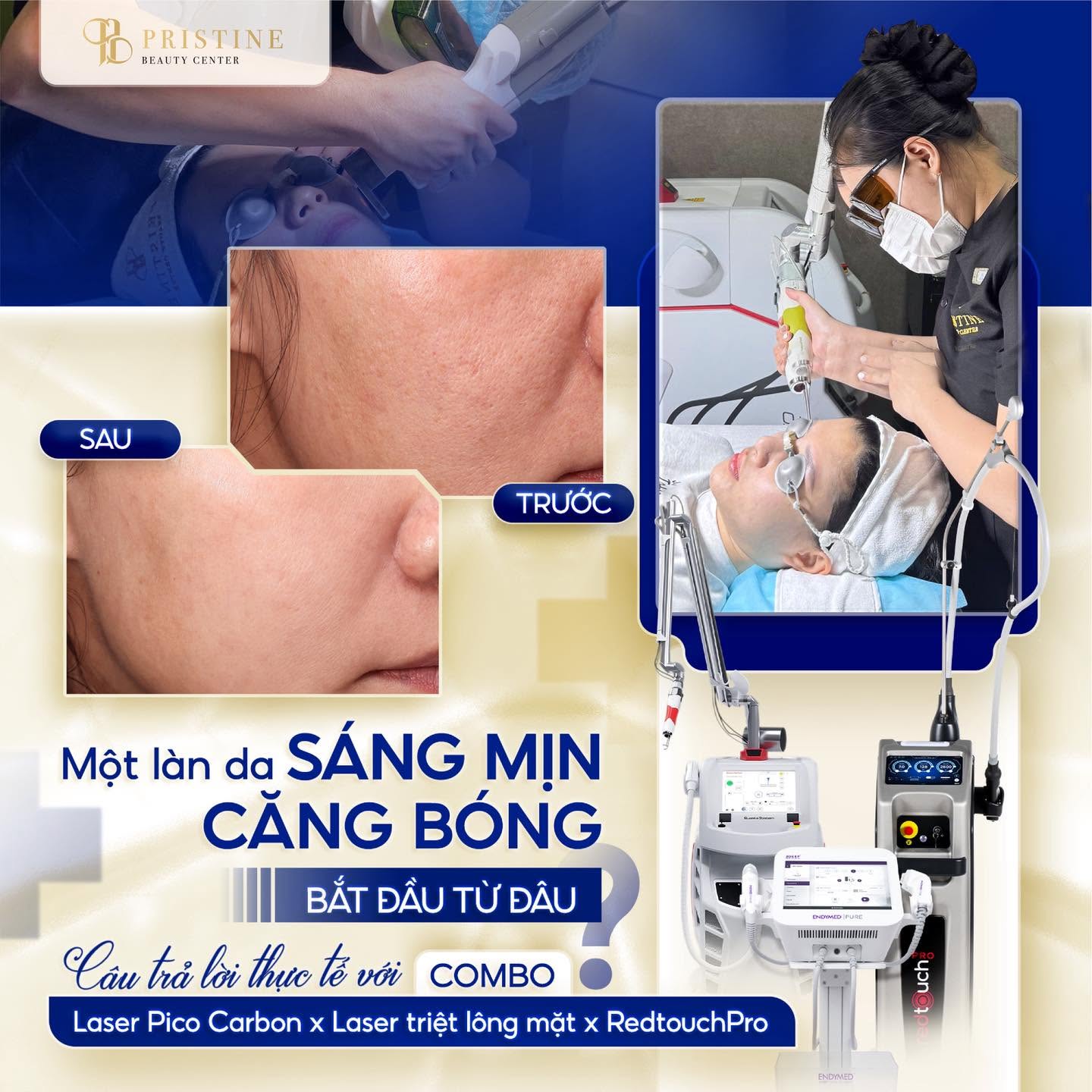 Chọn đúng công nghệ để hạn chế những ảnh hưởng có thể gặp sau khi triệt lông mặt