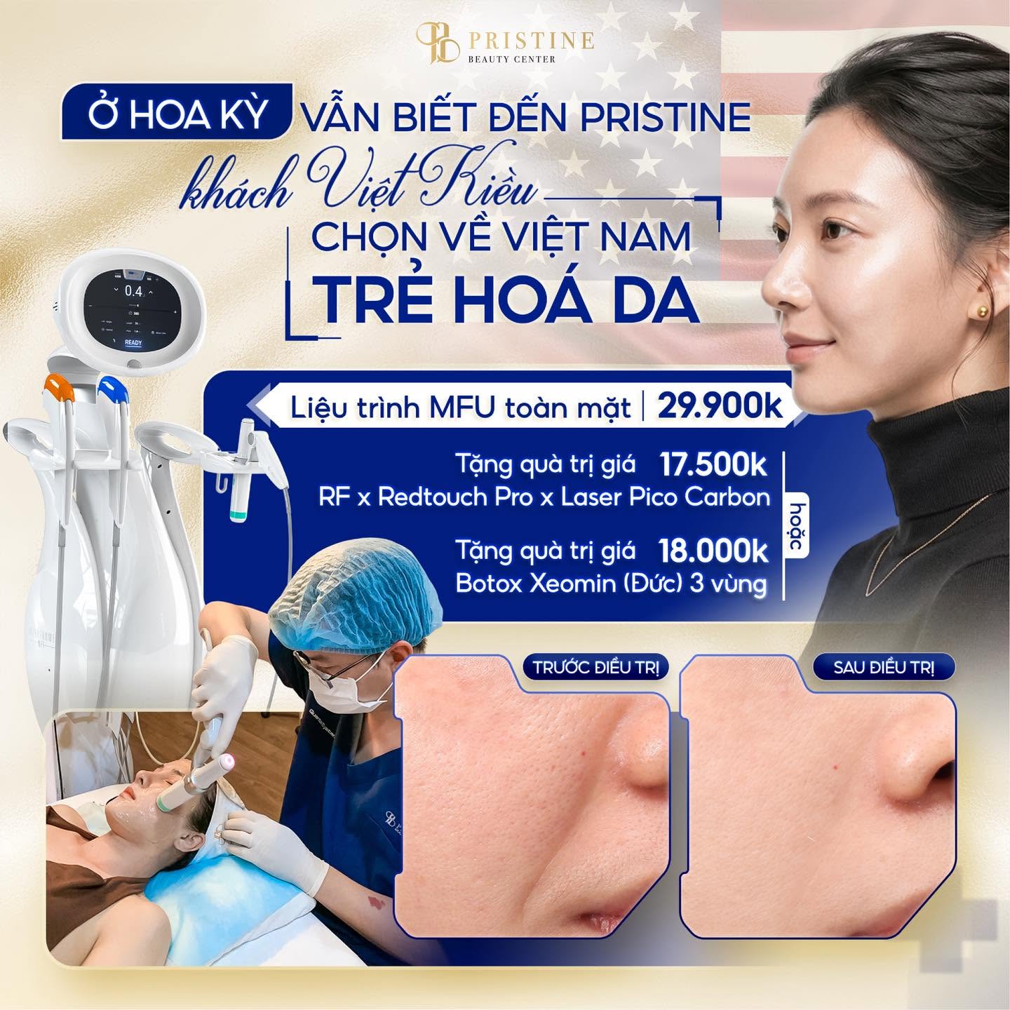 Các công nghệ nâng cơ không phẫu thuật hiện nay: MFU, HIFU, RF khác gì nhau? 7 Pristine Beauty Center kết hợp MFU và RF hiện đại mang đến phác đồ trẻ hóa da toàn diện, chuẩn y khoa