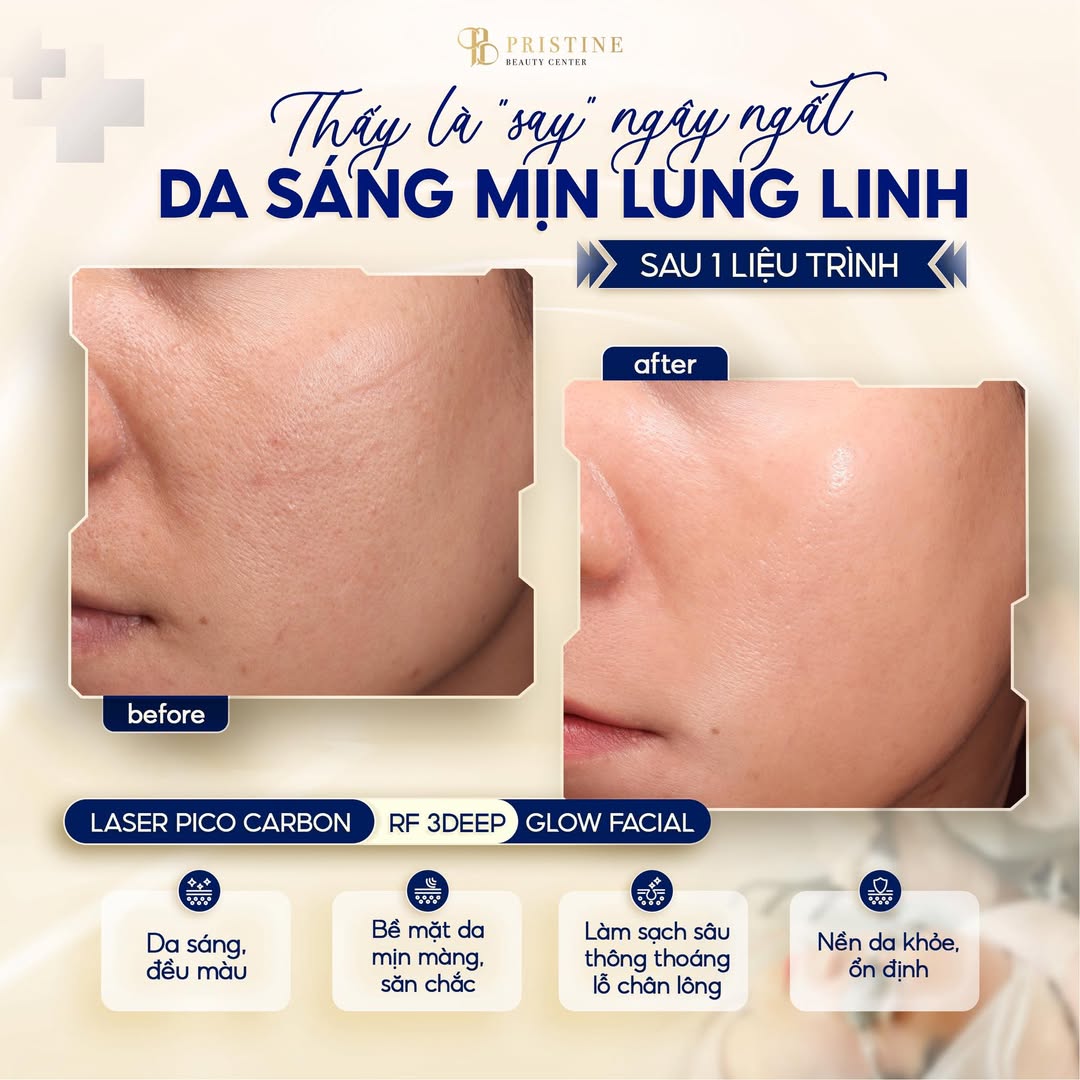 Discovery laser giúp phá vỡ sắc tố mạnh mẽ mà vẫn bảo vệ cấu trúc da, rút ngắn thời gian hồi phục tối đa