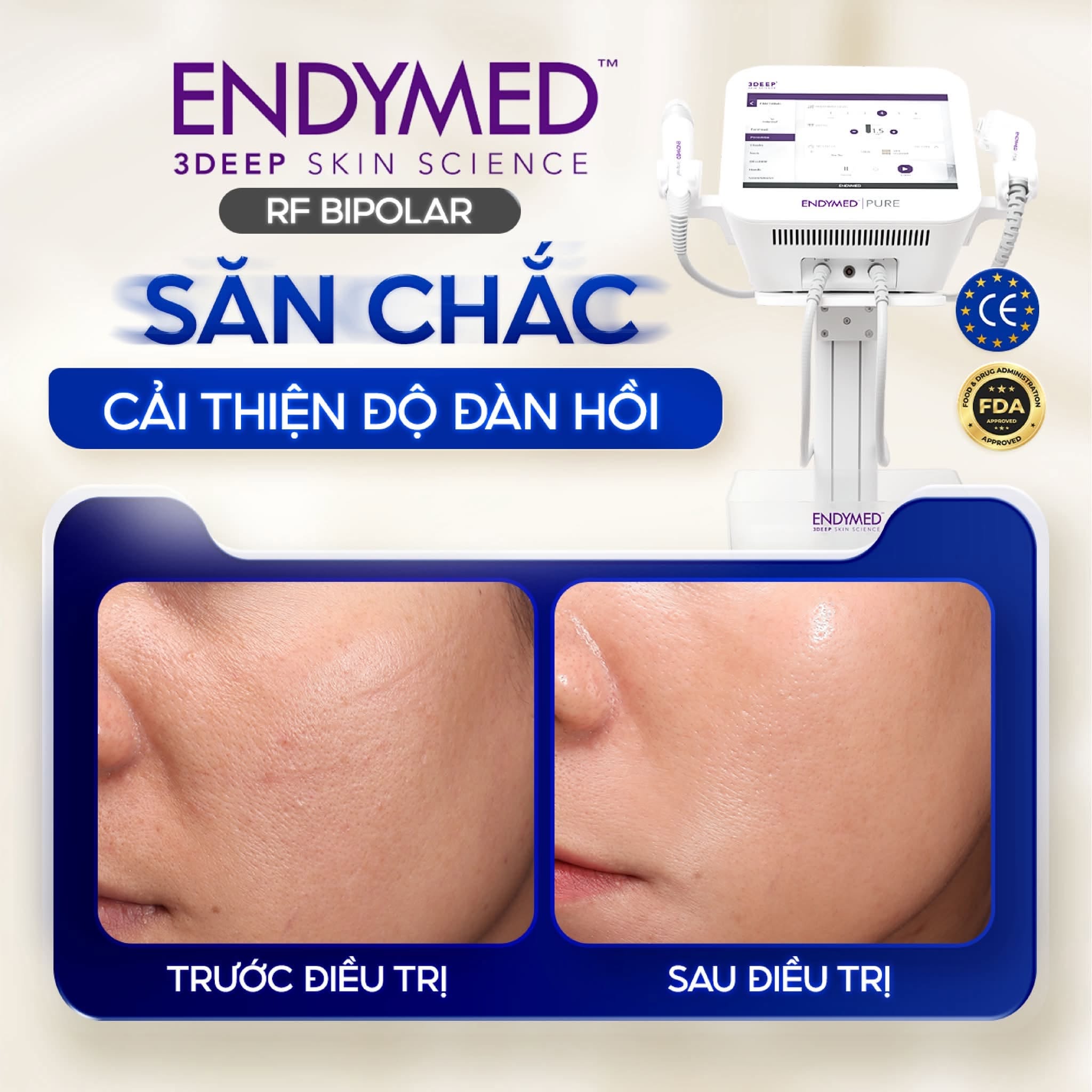 Nâng cơ trẻ hóa da tại Biên Hòa: Phòng khám nào có công nghệ xịn nhất? 7 RF Bipolar cải thiện độ đàn hồi và tình trạng da kém săn chắc