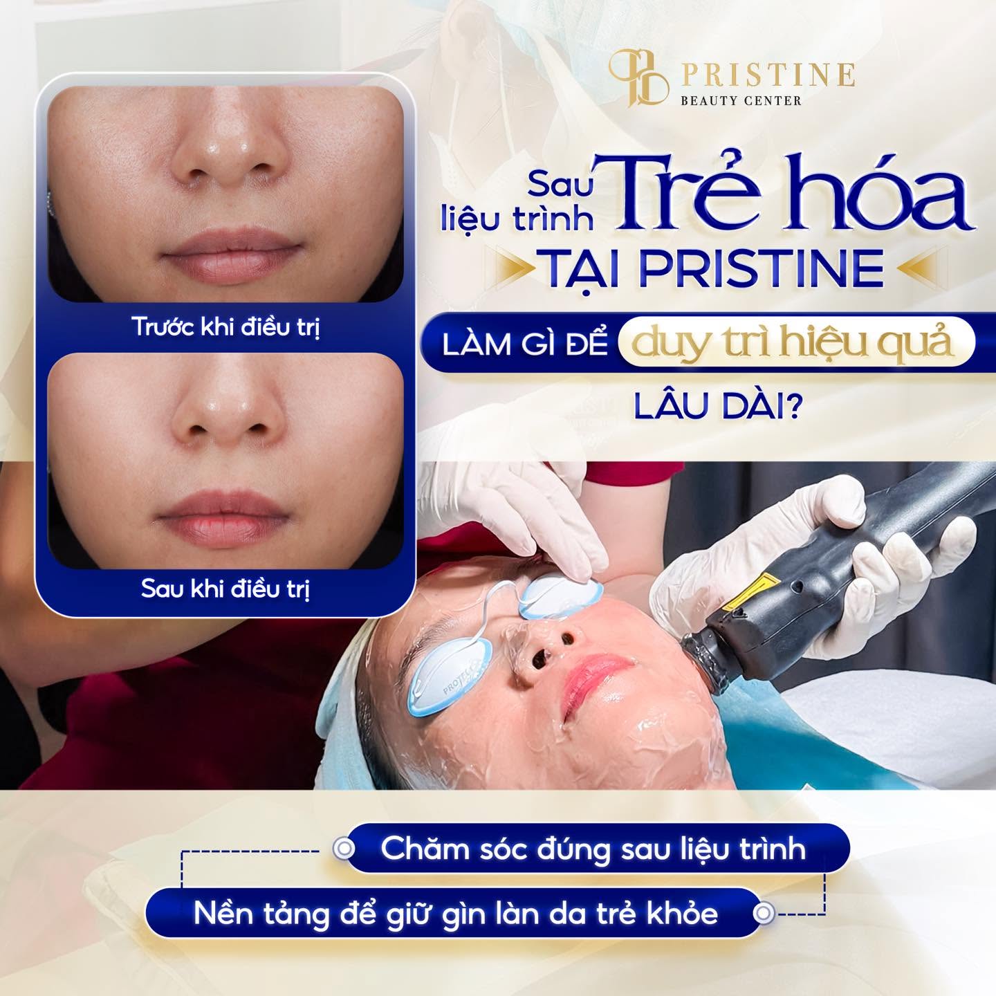 Ultraformer MPT vs Thermage FLX: Nên lựa chọn công nghệ nào? 5 Những lưu ý khi lựa chọn công nghệ nâng cơ, trẻ hóa da